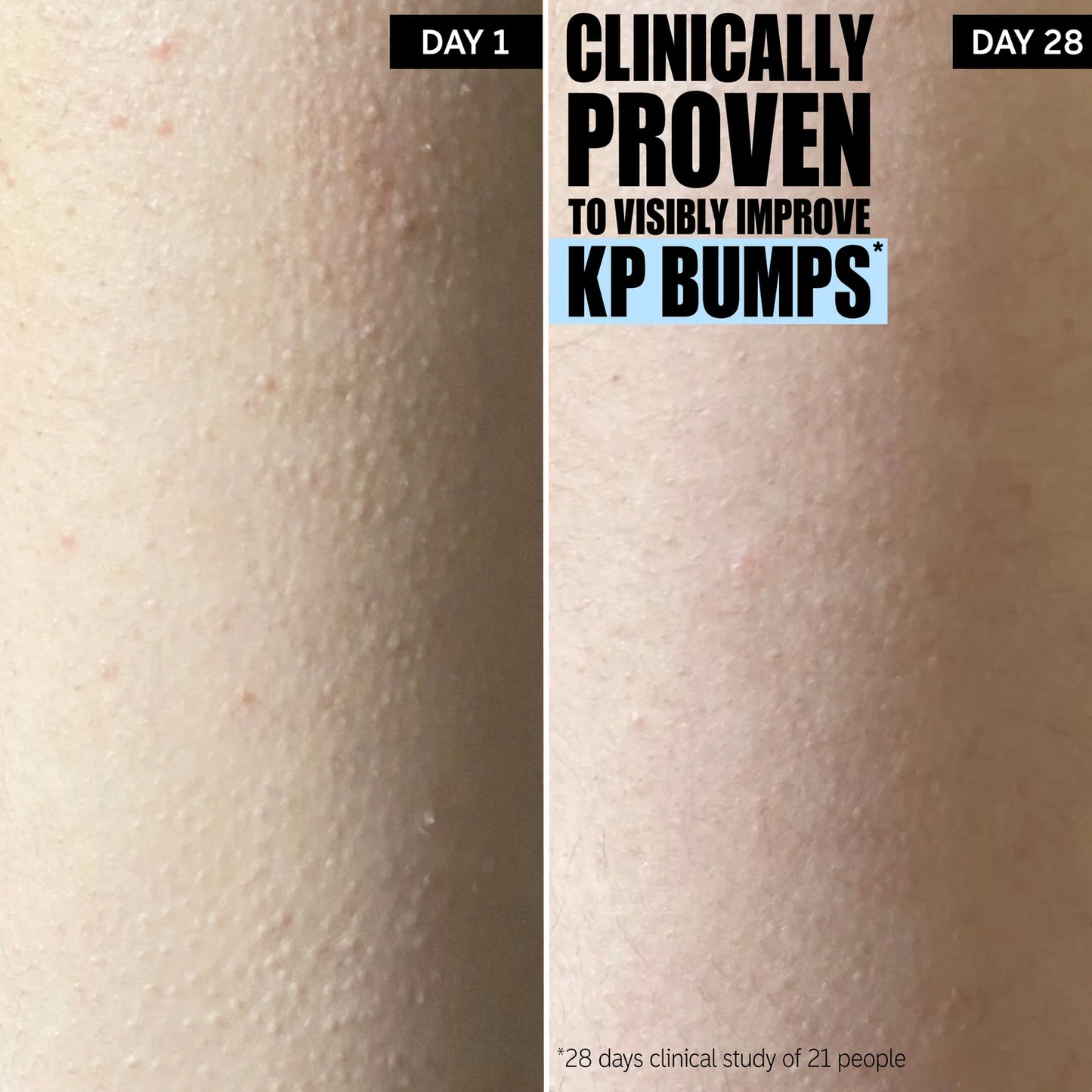 THE INKEY LIST GYLCOLIC ACID EXFOLIATING BODY STICK